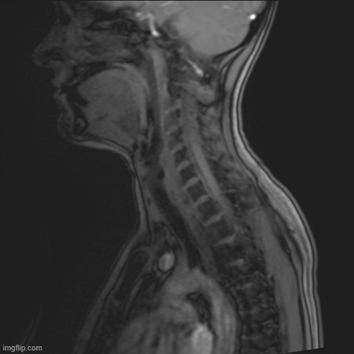 gif of mris of neck flashing through diffrent views